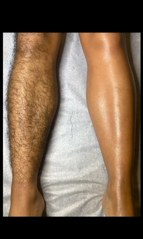 Lower Leg