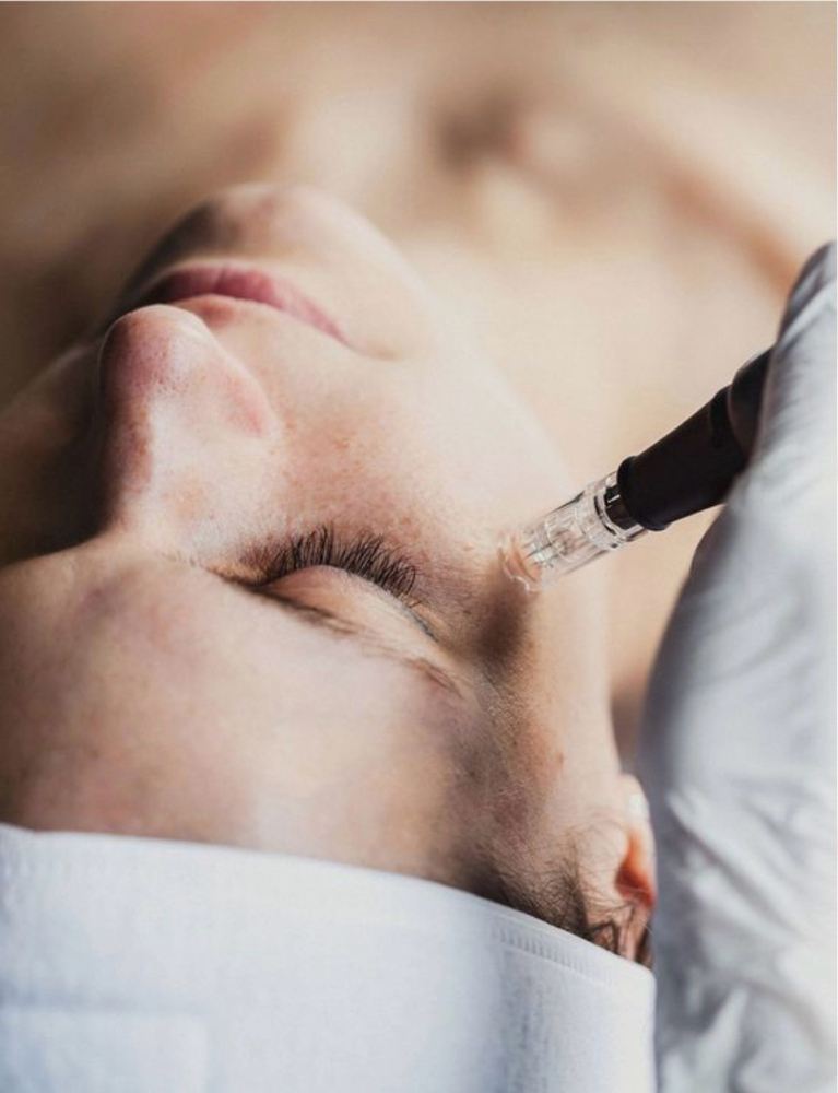 Collagen P.I.N at Skin By Ragan in Columbus, MS