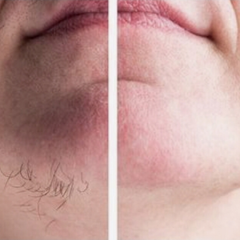 Wax - Chin at Revive Skin and Soul, LLC in Danville, KY