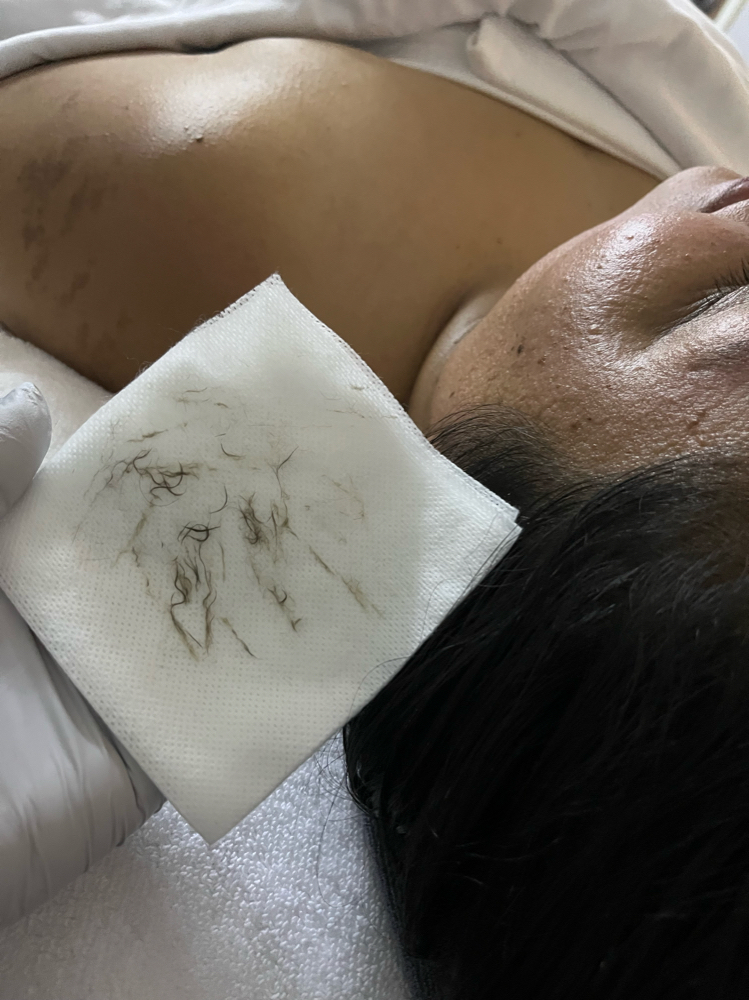 Dermaplane Add-on