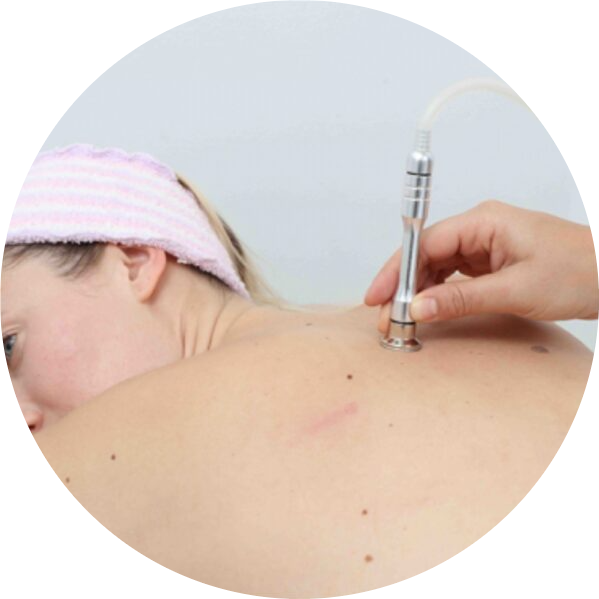 Microdermabrasion - Back