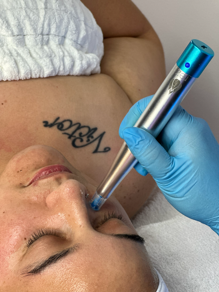 Retrograde Signature Facial