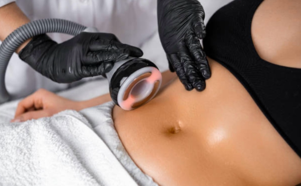 Body contouring - 3 Pkg