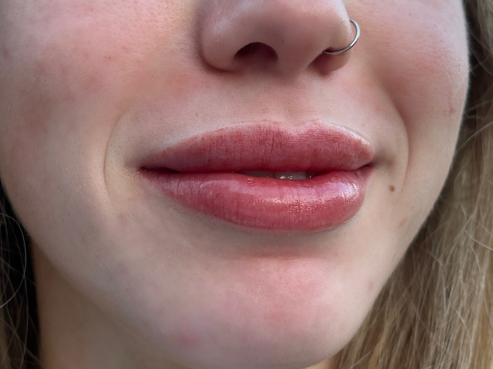 Lip Blushing