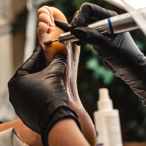 CALLUSES TREATMENT ONLY at Alona Beauty Studio European Permanent Makeup & Nail Art in Foley, AL