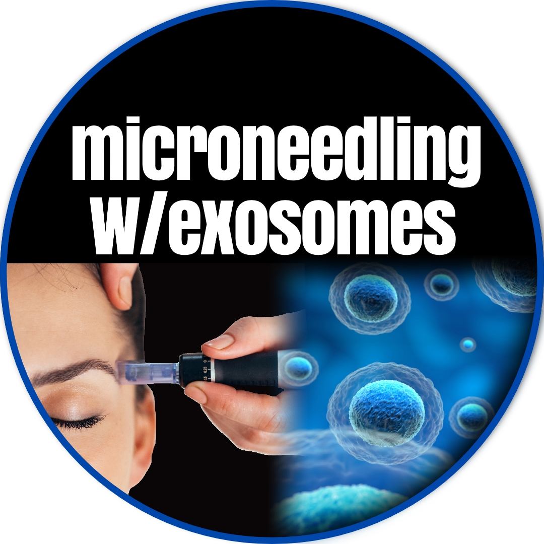 Microneedling with Exosomes