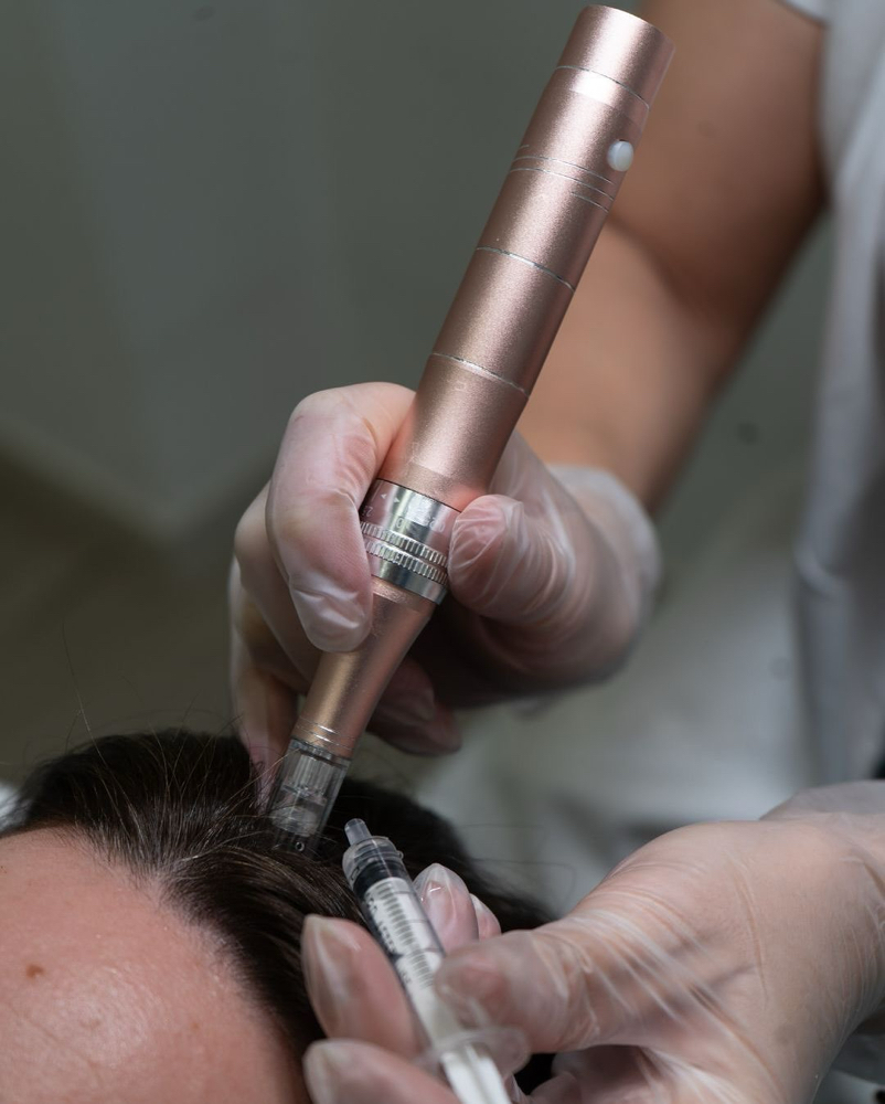 Hair Regrowth Therapy