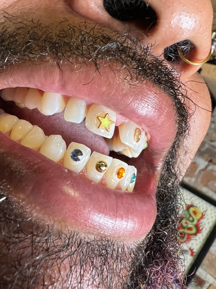 Tooth Jewelry Consultation
