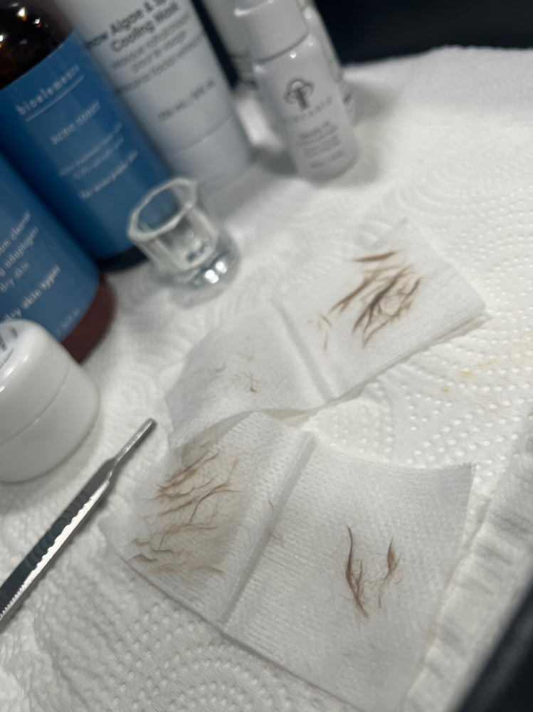 Simple Dermaplane Facial