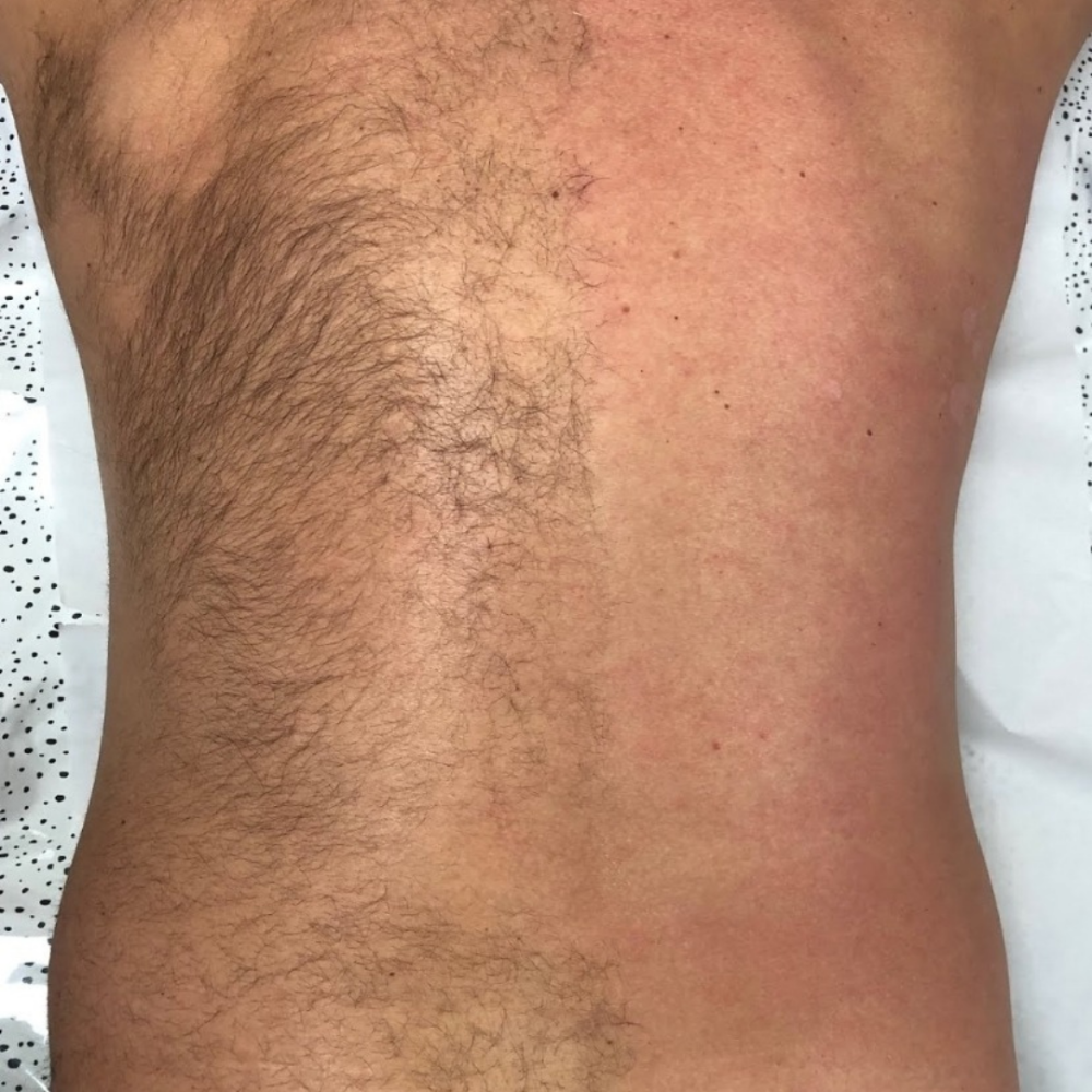 Back/Espalda at Mobile Bliss By Shar, LLC in Rochester, NY