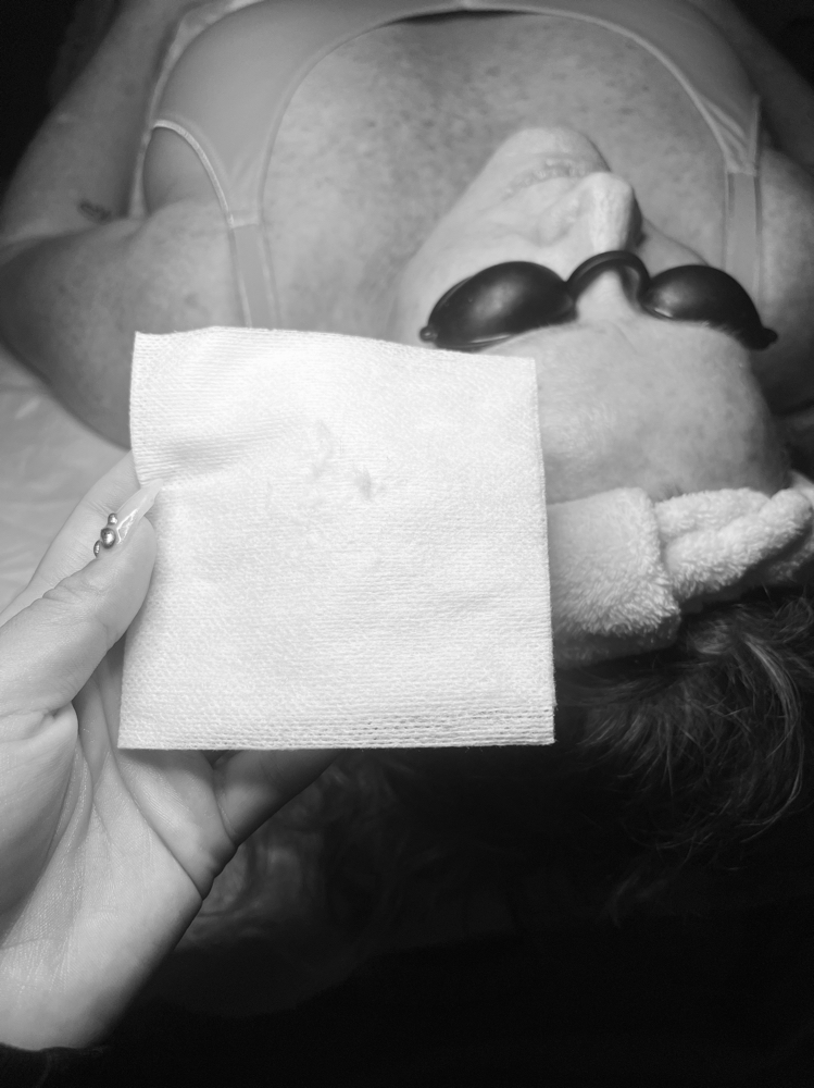 Dermaplane Facial