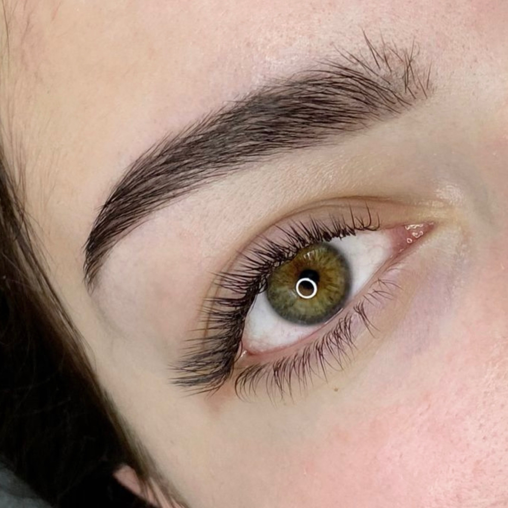 Teenage Eyebrow Correction