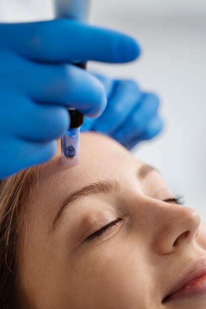 Microneedling at Skin Therapy LLC in Lincolnton, NC