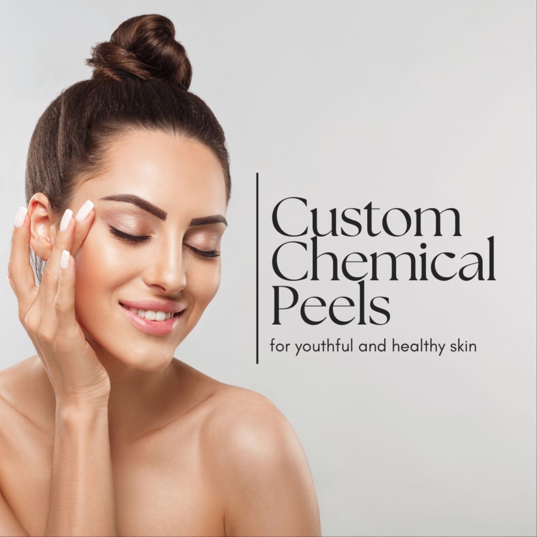 Custom Chemical Peels (PCA) at Shannon Christine Skin in Sparks, NV