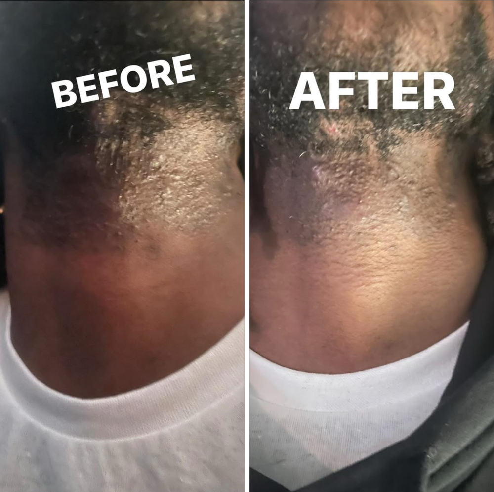 Neck Rejuvenation Treatment at Tekila’s Timeless Touch in Flint, MI