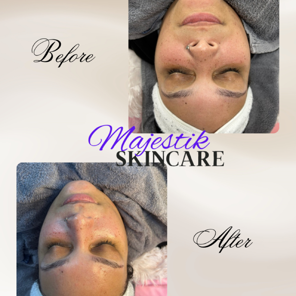 Basic Facial at Majestik Skincare in Mobile, AL