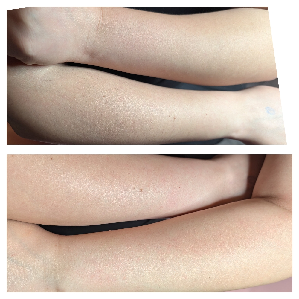 Full arm wax