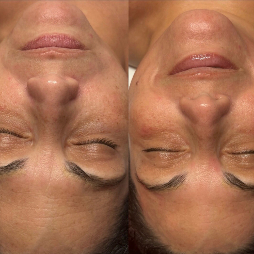 The Glowtox Ritual at Red Moon Esthetics in Orlando, FL