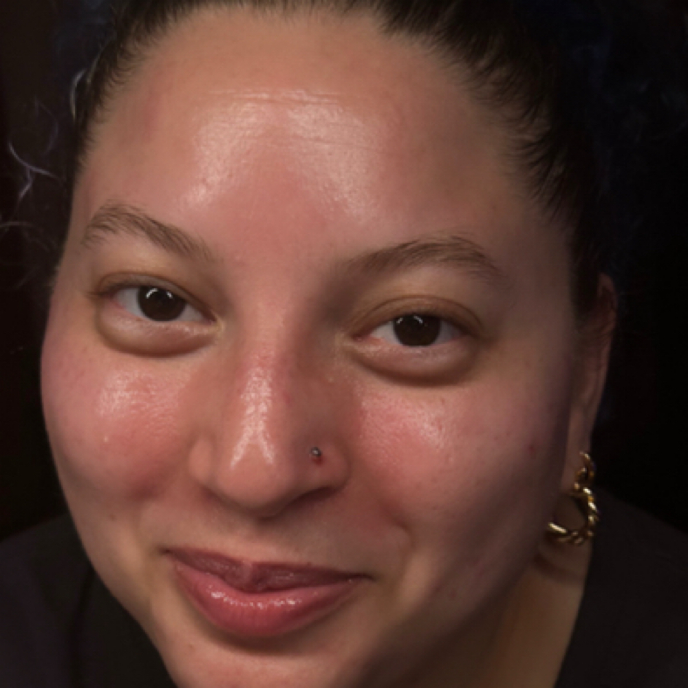 The Glowtox Ritual at Red Moon Esthetics in Orlando, FL