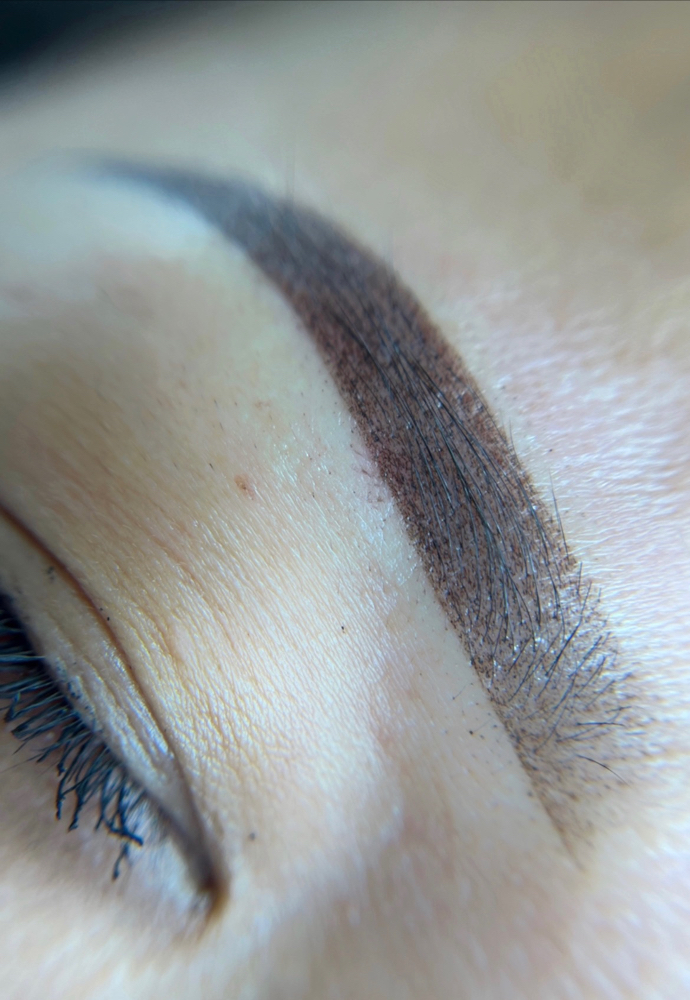 Brow Correction