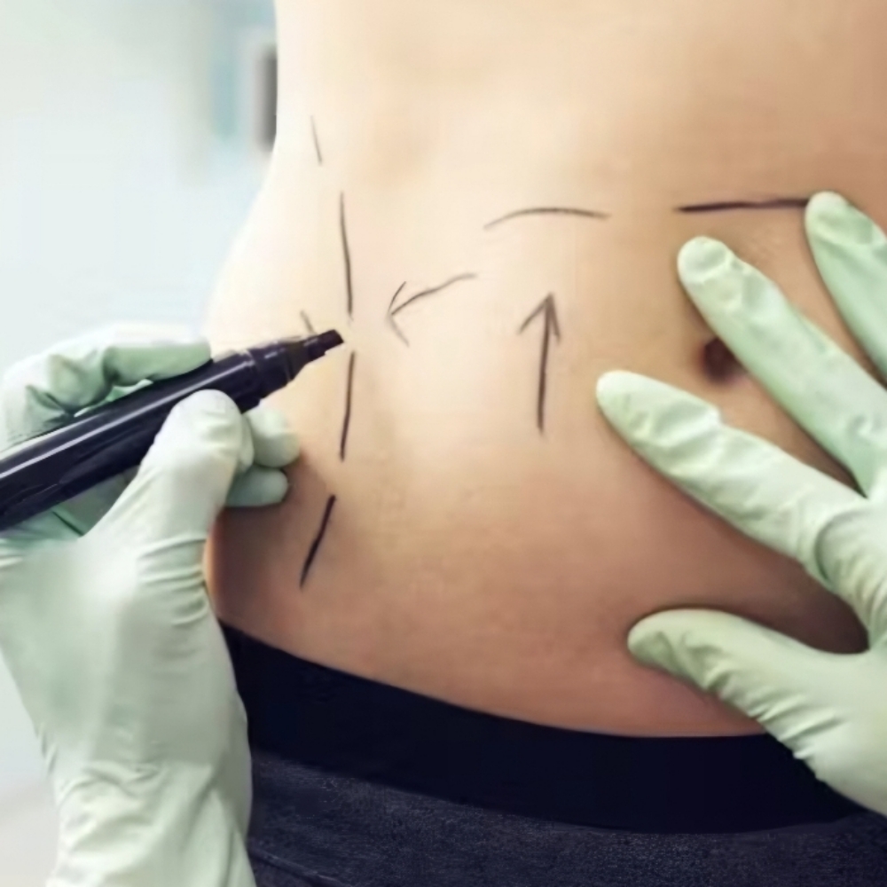 Free Body Contouring Consultation at Arukah Therapy in Cypress, CA