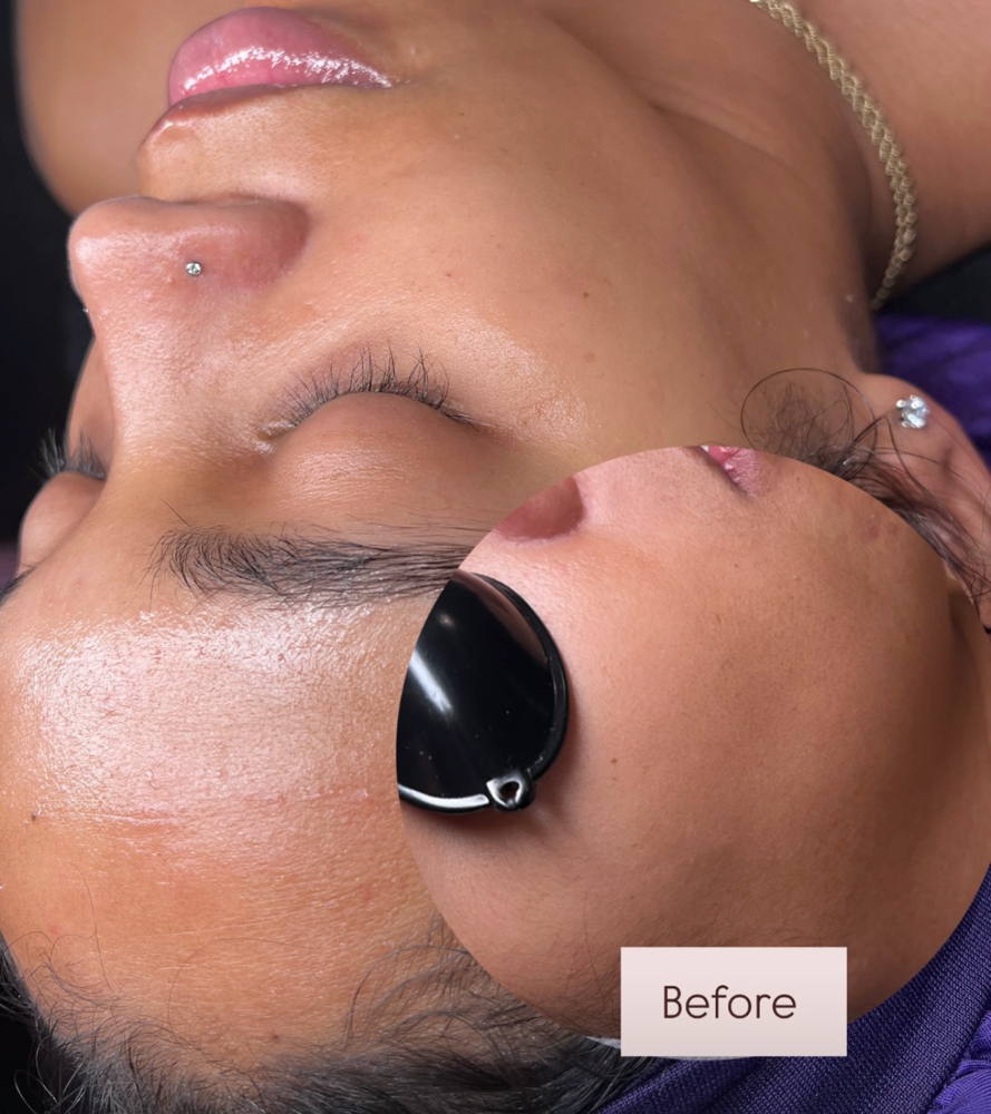 Dermaplanning Spa Facial