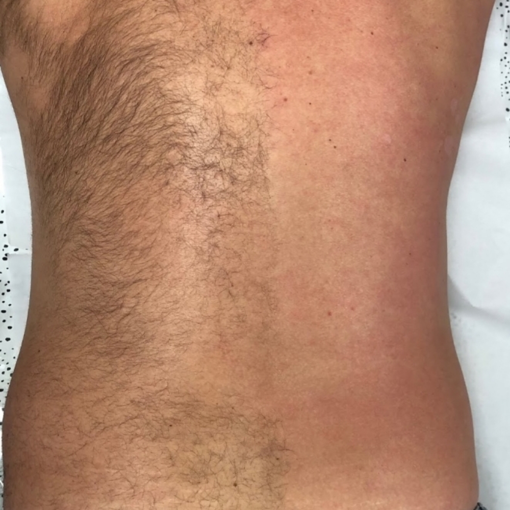 Back Wax at 121 Studio in Marshall, IL