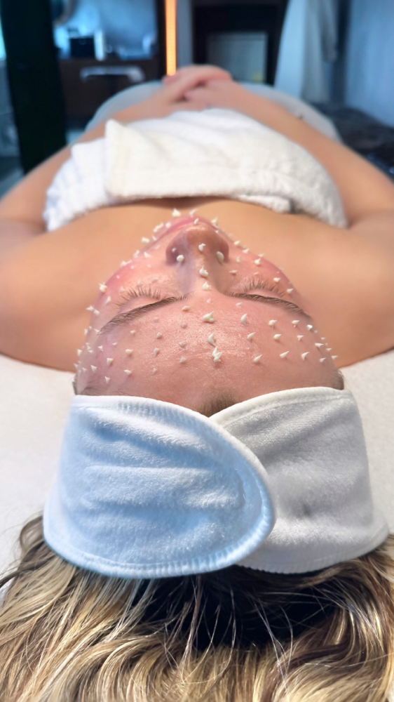 LIQUID MICRONEEDLING at CE SKIN GARDEN in Middletown, NY