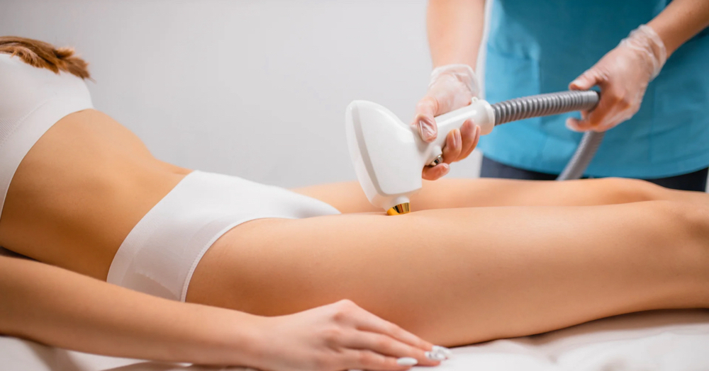 Laser Hair Removal Full Body