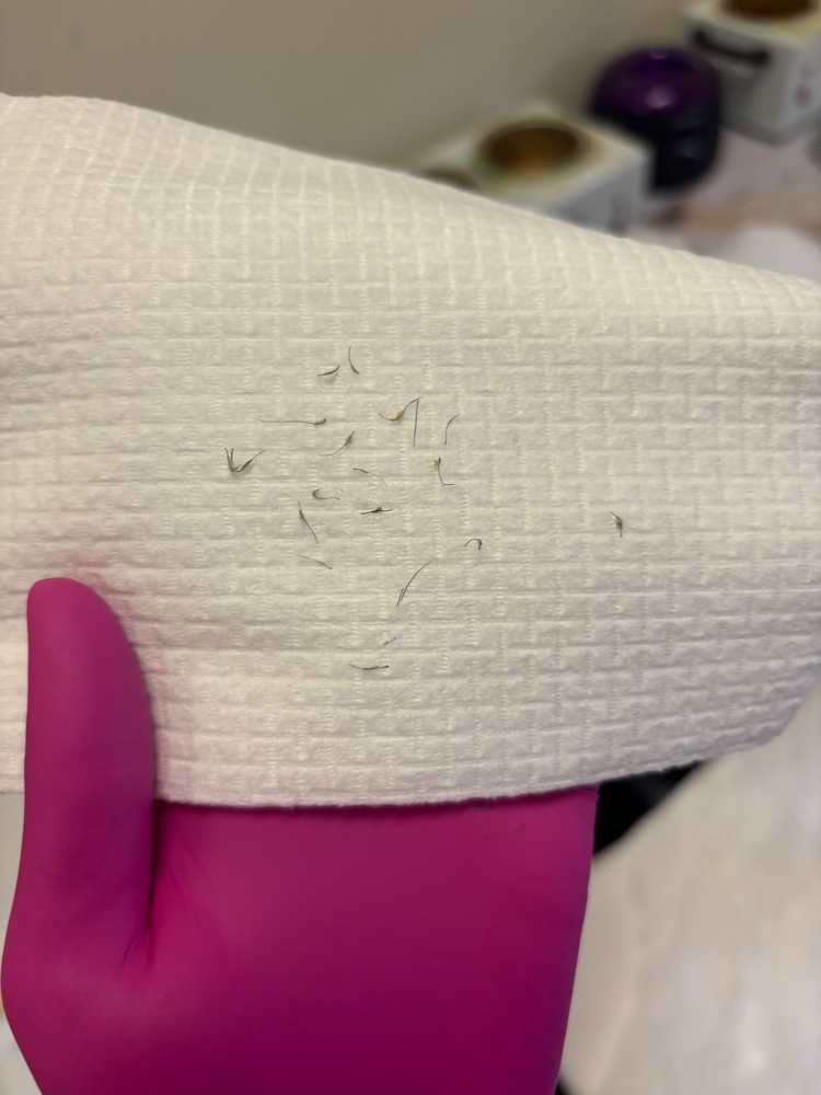 Vajacial at Her Beauty in San Jose, CA