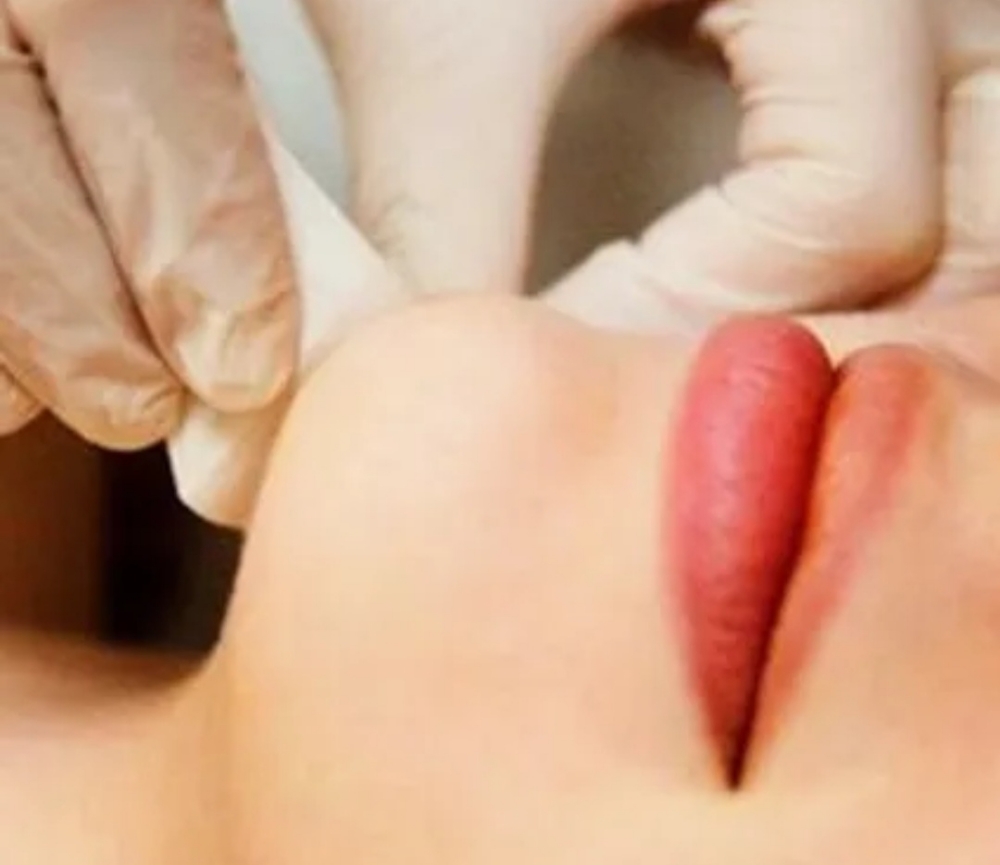 Chin Wax