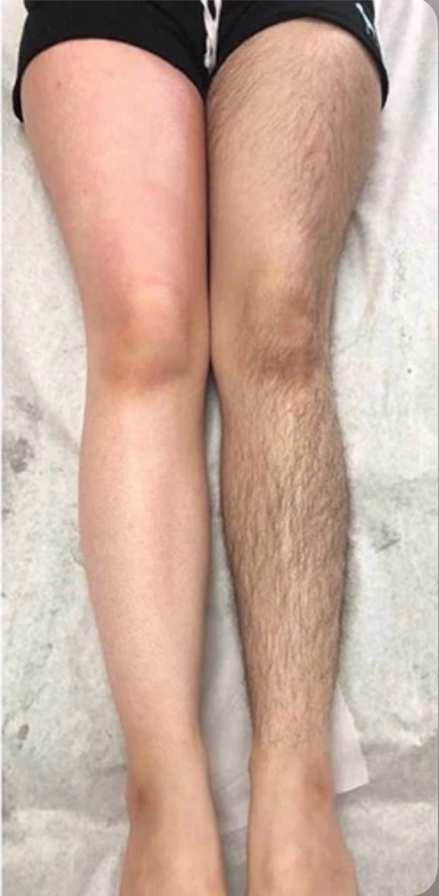 Full Legs Wax
