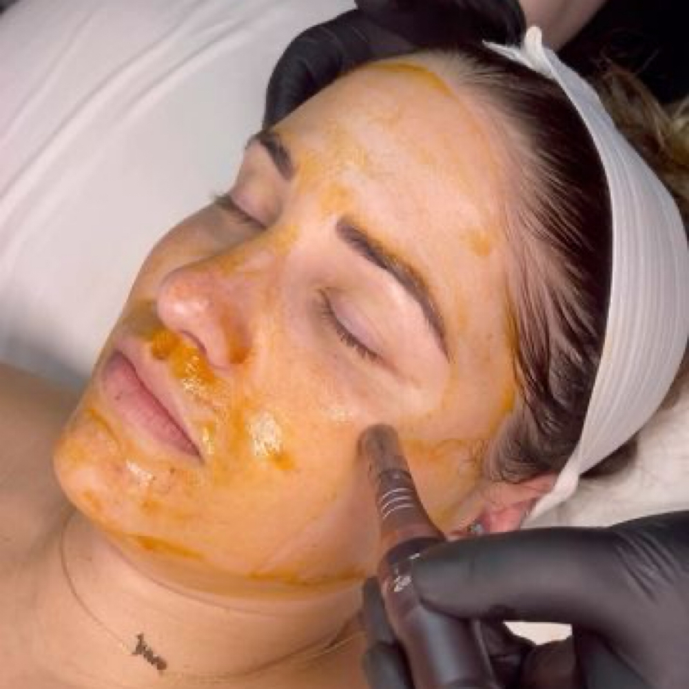 Nano Infusion at Skin Theory-Katie in Perry, FL