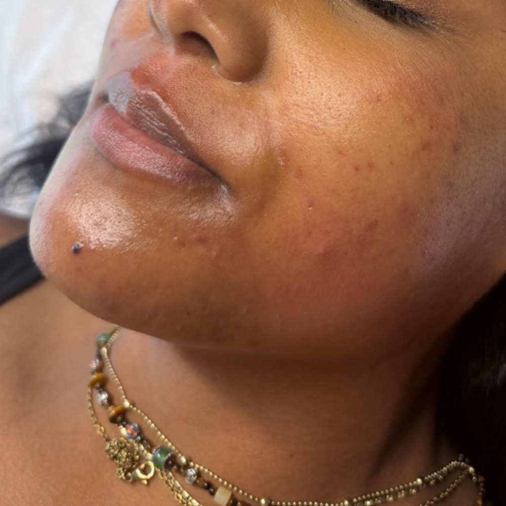 Chin Wax at Botanical Beauty Bar in Austin, TX