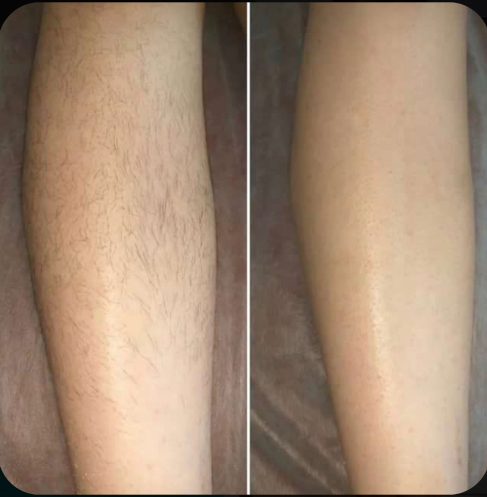 Leg Wax