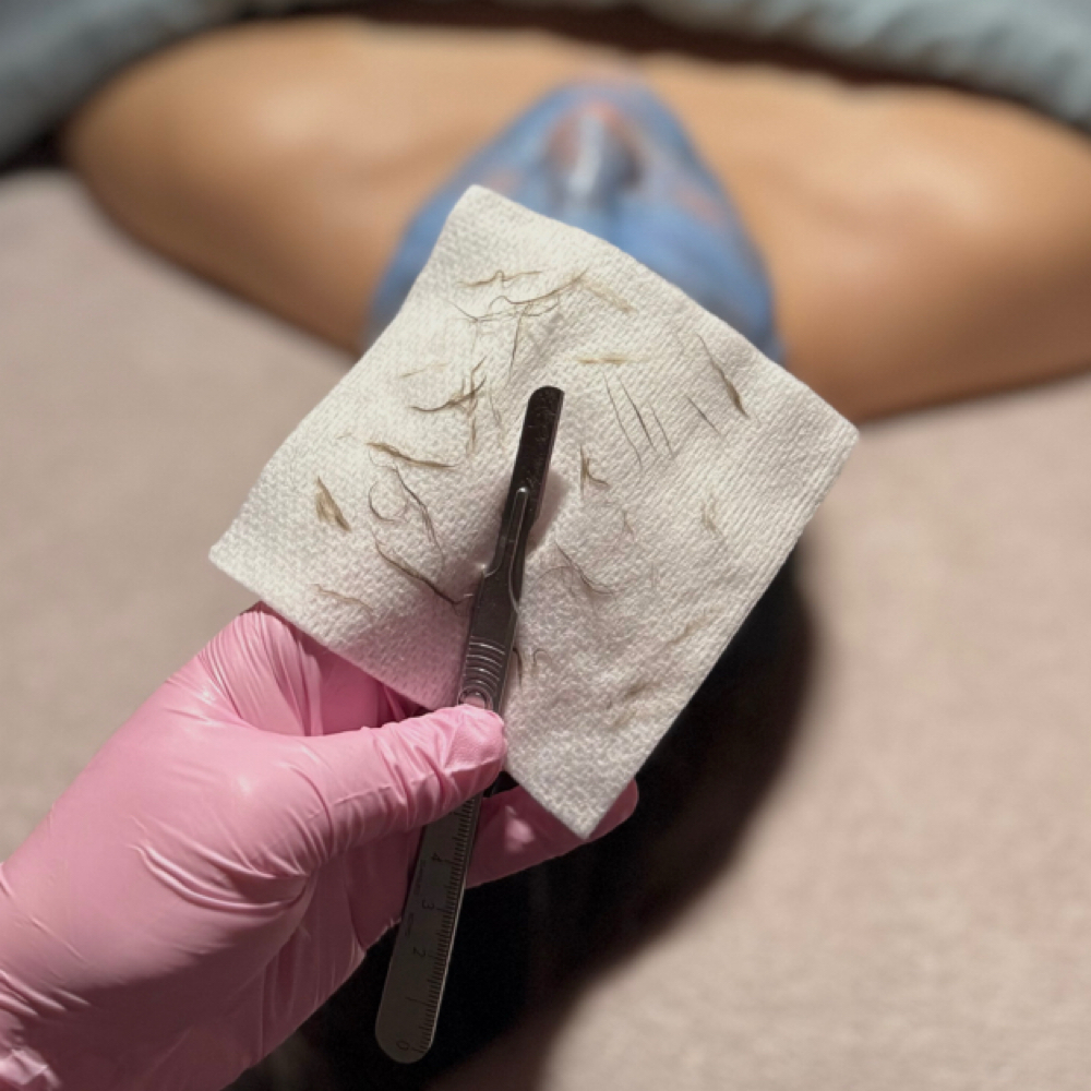 Dermaplane Only at Taylor’d To You - AWE Skin Studio in Lebanon, TN