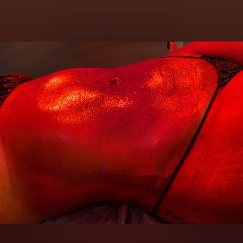 Elit8 Post OP Lymphatic Massage