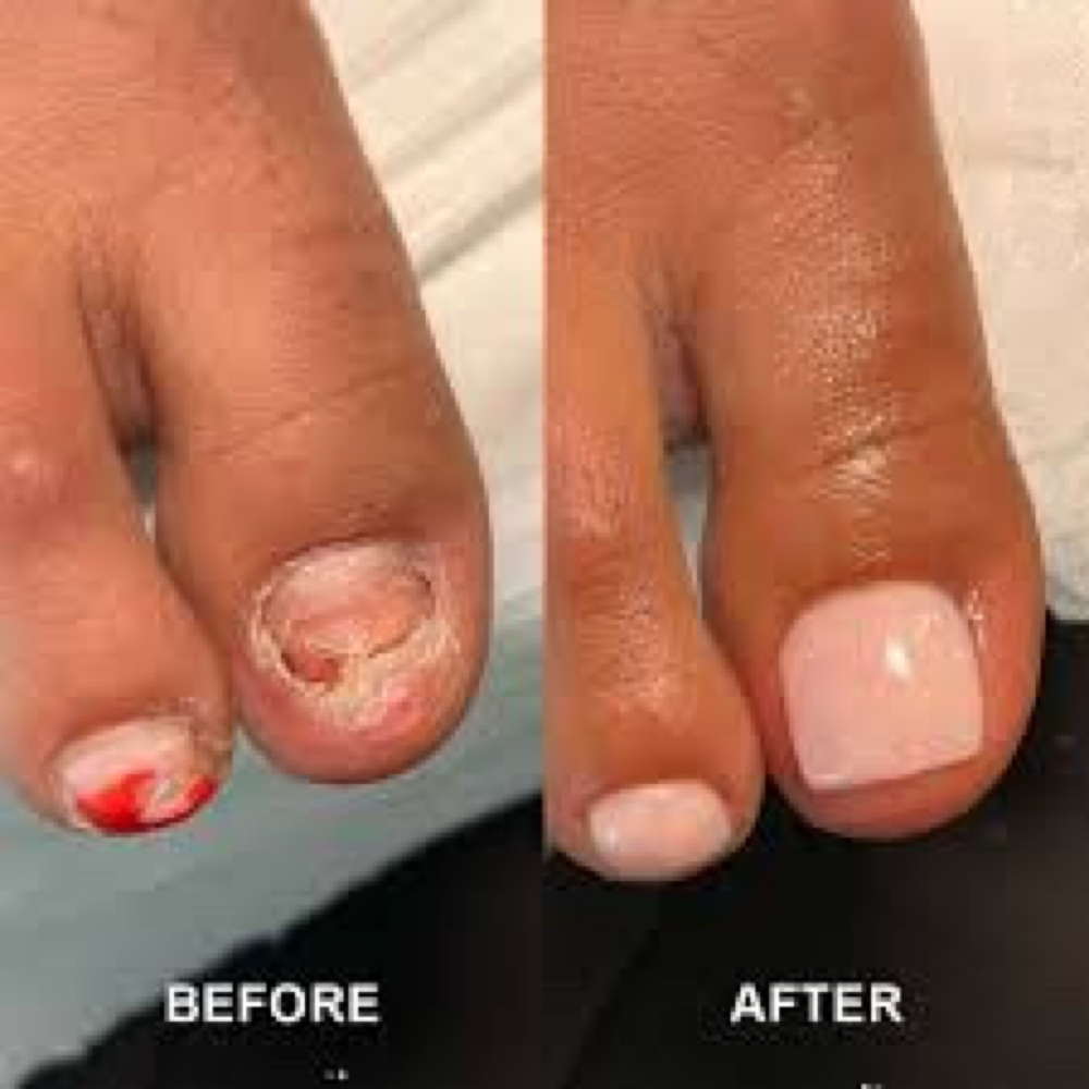 Toe Nail Reconstruction at EmpowerHer Beauty in Zillah, WA