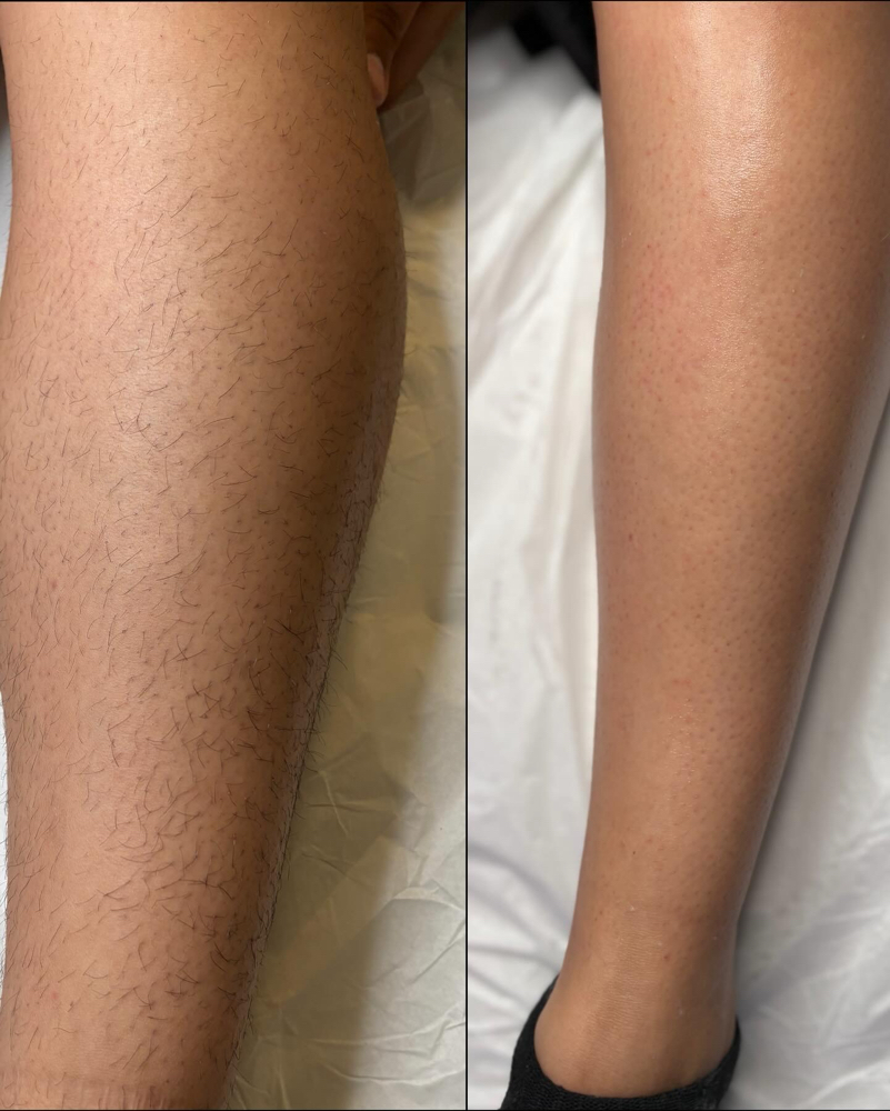 Full Leg Wax
