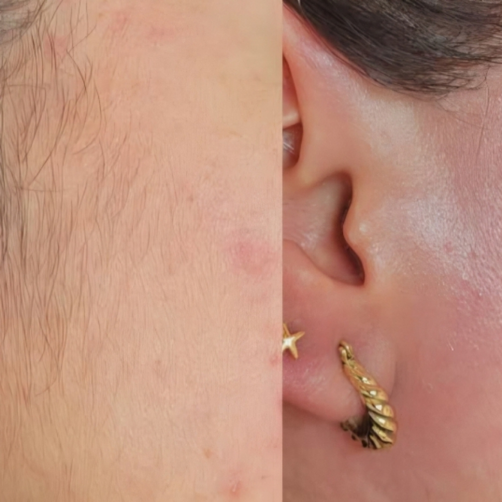 Sideburns Waxing at Entouch Day Spa  |   La Pine's Premier Facial Spa & Waxing Studio in La Pine, OR
