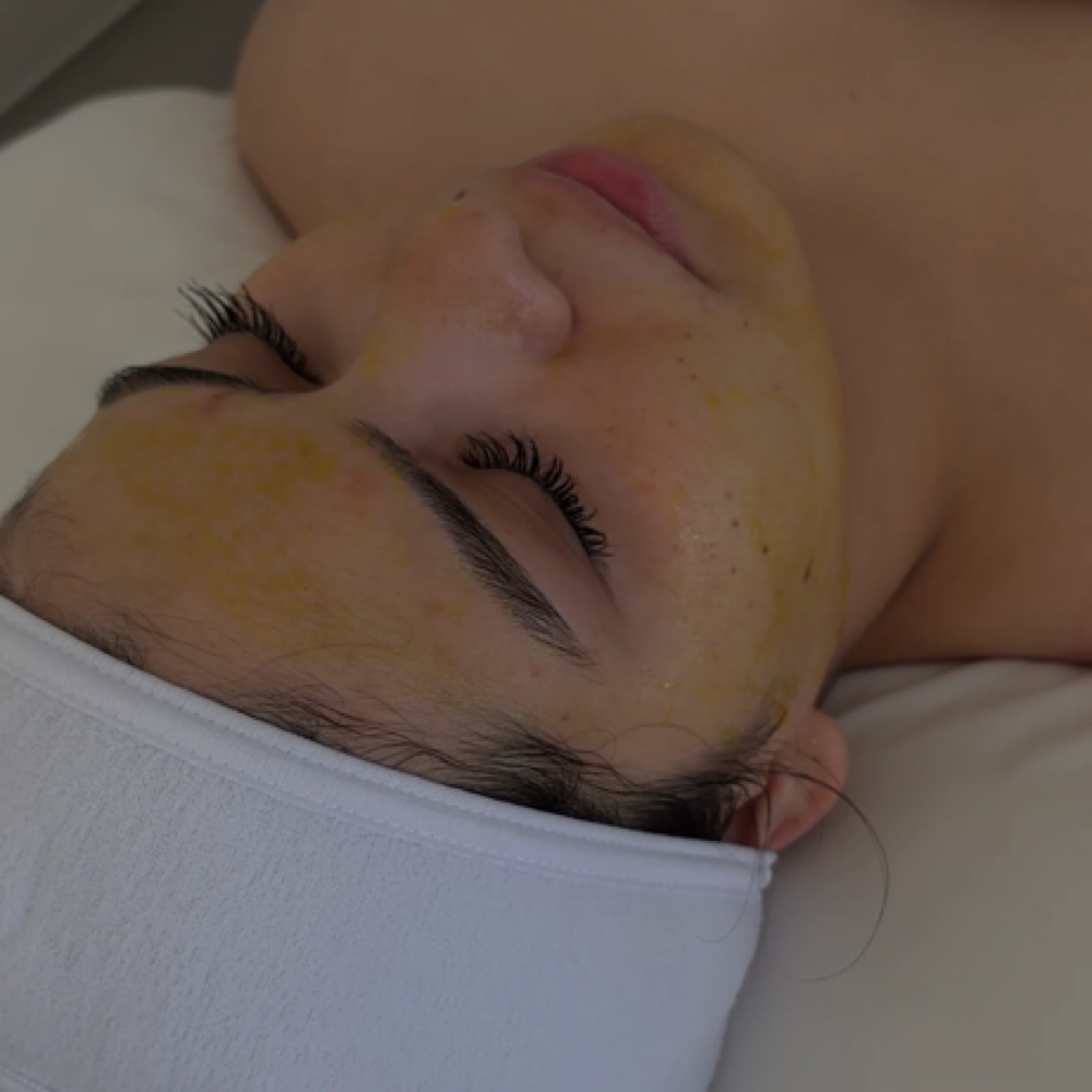 The BioRePeel Treatment at Baire Skin Spa in Visalia, CA