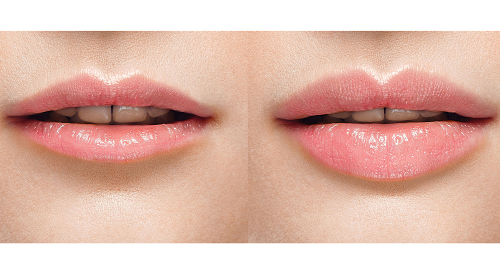 Hydrating Lip Treatment