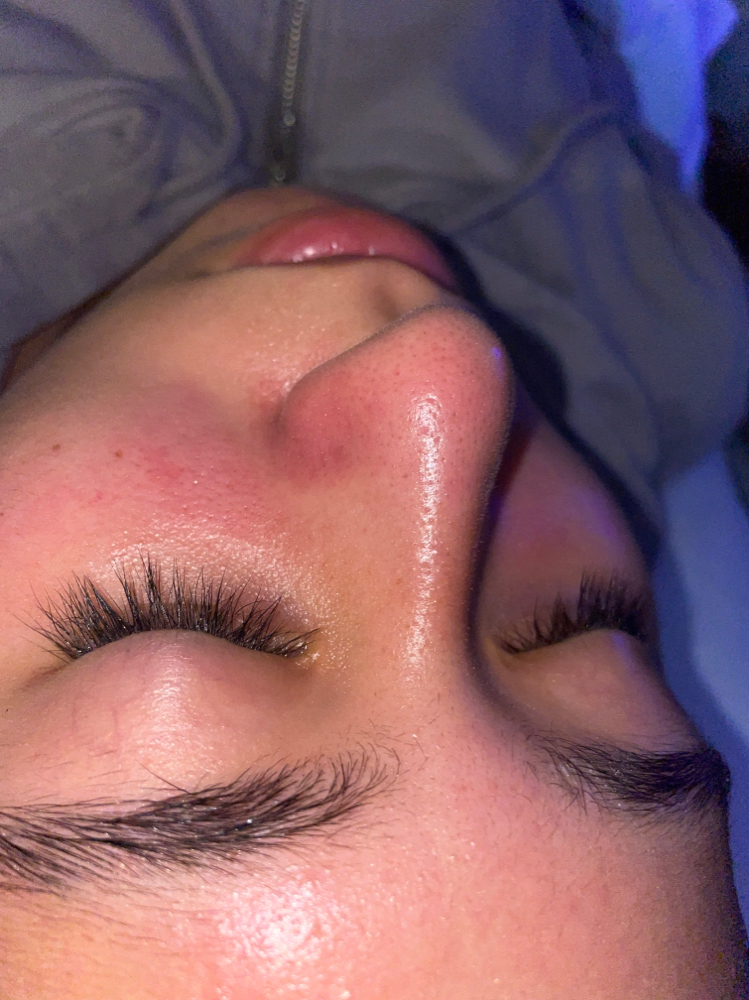 Teen Facial