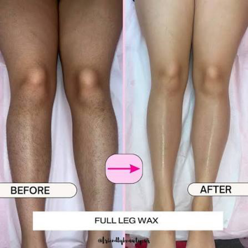 Full Legs at WaxLand & BodySculpting in Los Angeles, CA