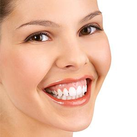 Gummy Smile Correction