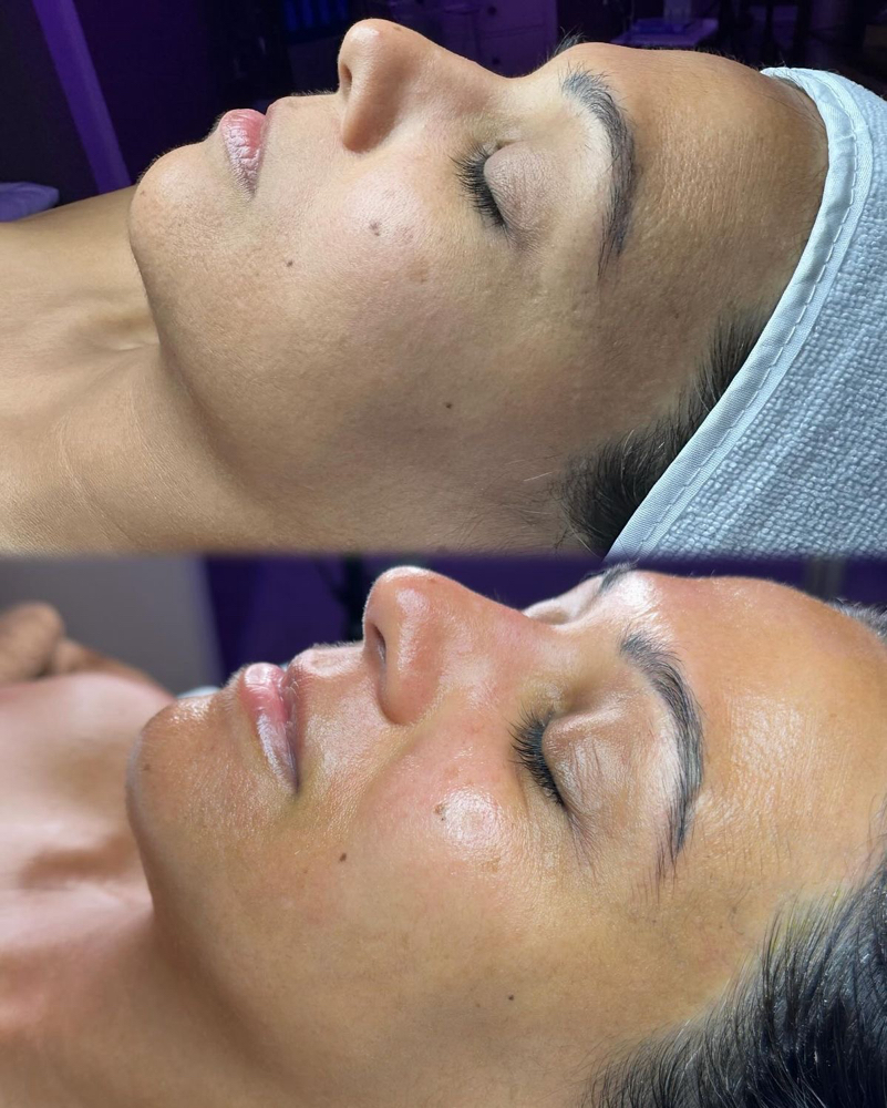 Express Facial