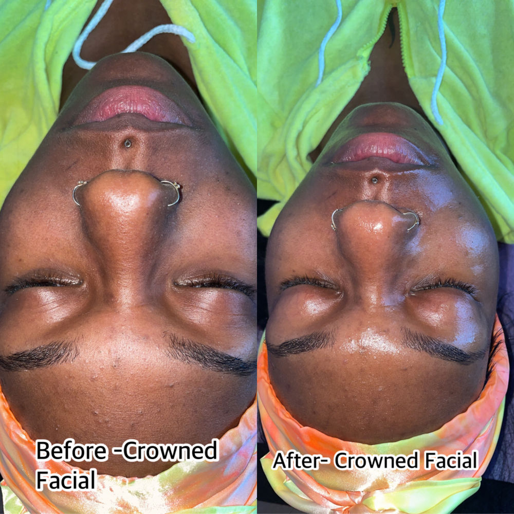 24K Gold Facial (jelly Mask Facial) at Crowned Exclusive Esthetics in Kansas City, MO