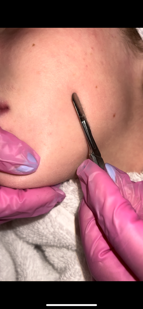 Dermaplane Special
