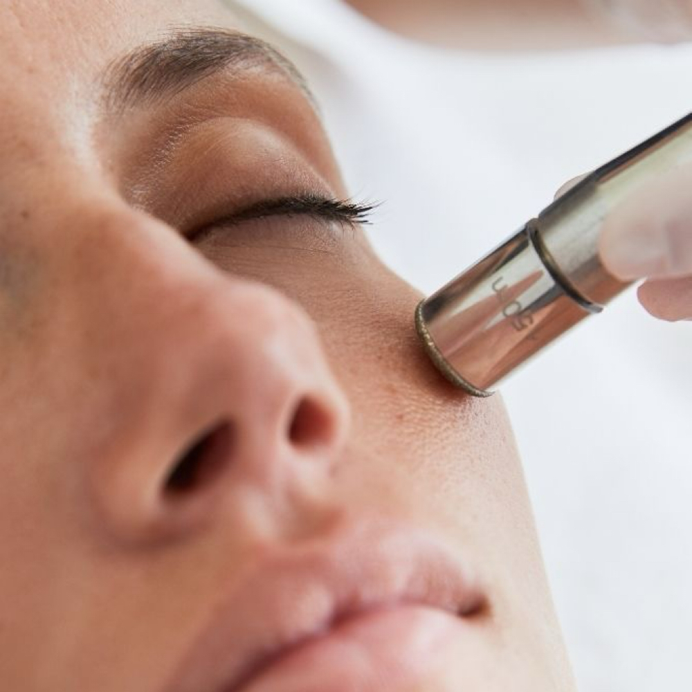 Microderm In&Out at The Skin Addict by Megan in White Plains, NY