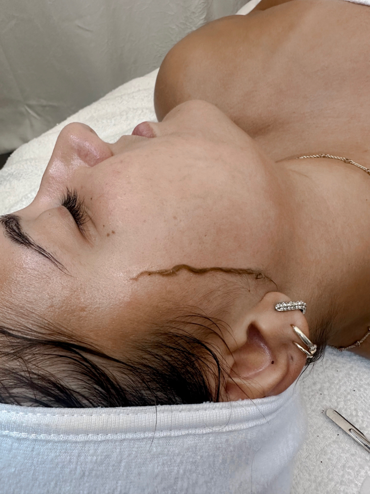 The Dermaplaning Facial